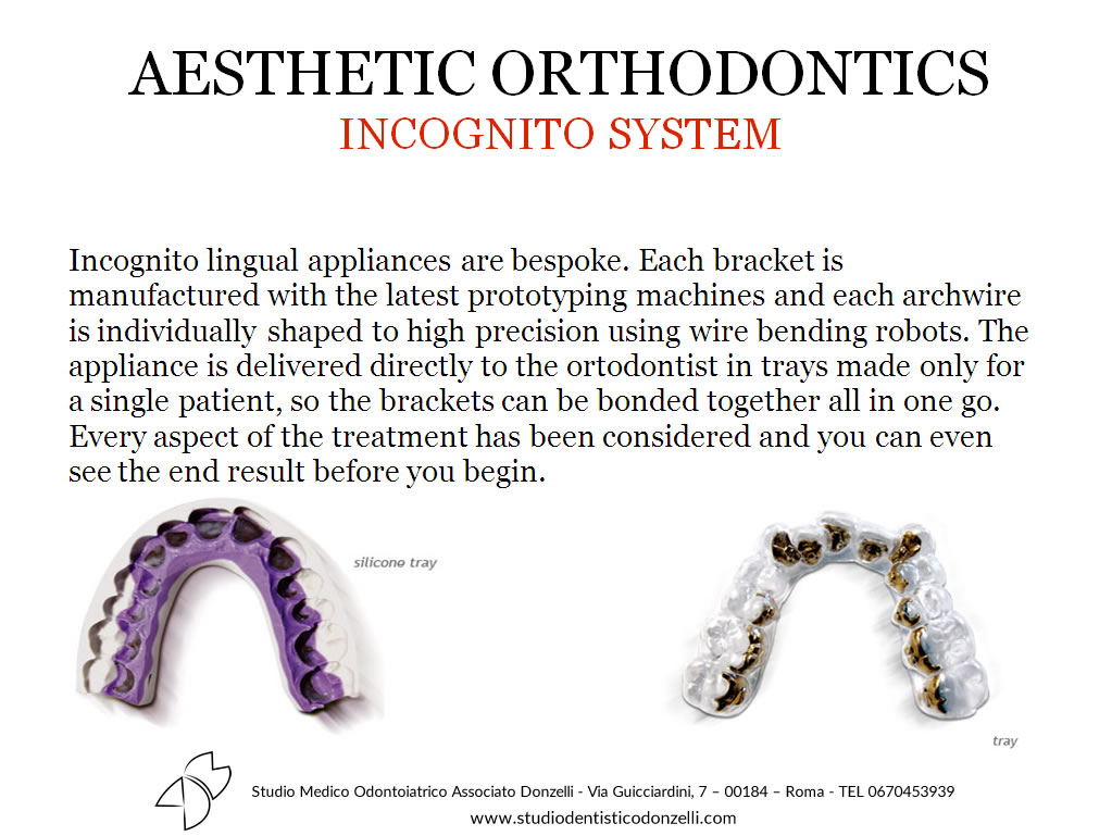 Aesthetic Orthodontics Incognito System - Studio Medico Odontoiatrico Donzelli
