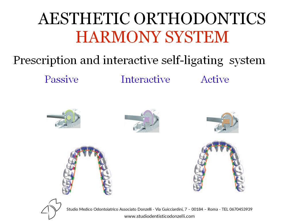 Aesthetic Orthodontics Harmony System - Studio Medico Odontoiatrico Donzelli